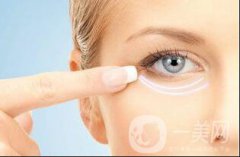 自體脂肪填充淚溝能保持多久？丨科普篇