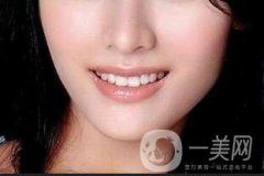 假體做下巴大概多少錢？