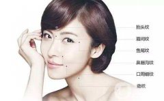 打注射除皺*佳年齡是多少歲