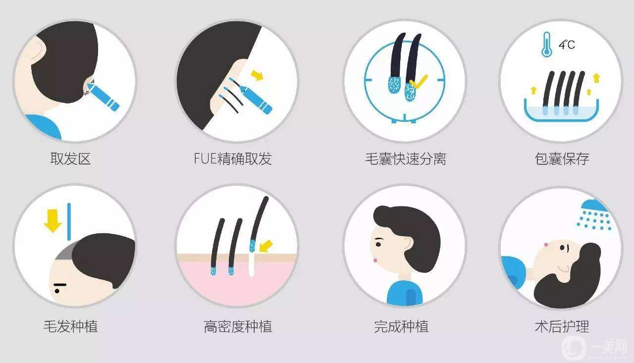 科普：植發(fā)3000單位要多少錢？脫發(fā)的原因