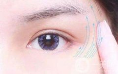 眼部除皺的價錢 怎么去眼周細紋
