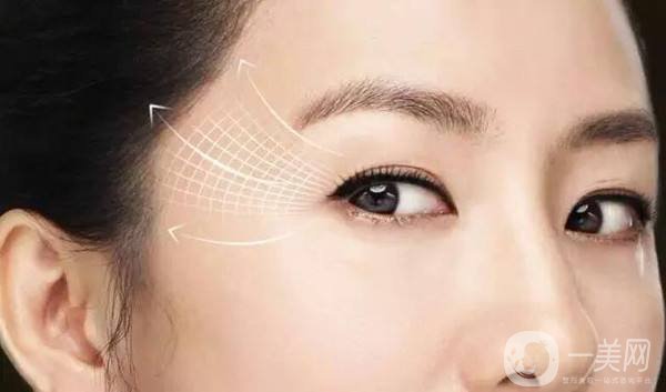 眼部除皺的價(jià)錢 怎么去眼周細(xì)紋