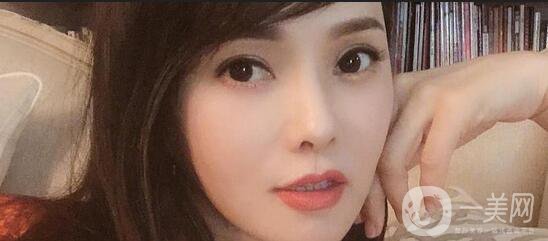 伊能靜整容