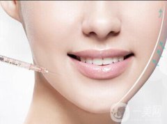 注射瘦臉一針多少錢(qián)？注射瘦臉*價(jià)格