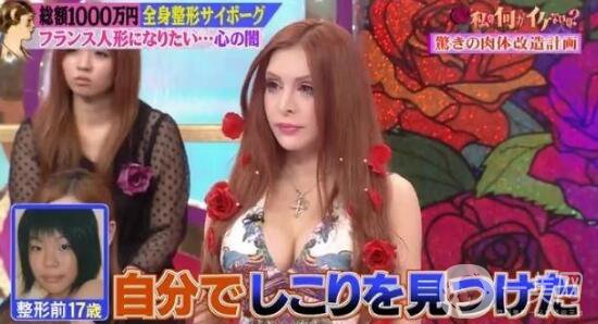 日本女人做整形手術(shù)：想成為活的“法國娃娃”