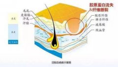 激光修復(fù)疤痕的副作用？對(duì)凹陷疤痕*嗎？