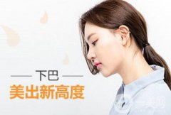 假體下巴風險有哪些？做完能管多久