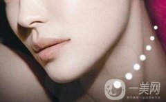 抽脂墊下巴多少錢？墊下巴選假體還是自體