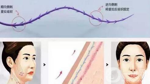 抗衰