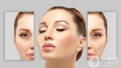 臉部哪里容易長(zhǎng)皺紋？臉上皺紋怎么去除