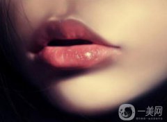 唇填充劑指南：比較不同類型的唇部注射