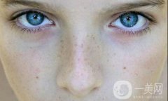 黑頭和白頭：有什么區(qū)別？