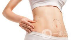 等離子光纖溶脂副作用 它的危害有哪些？