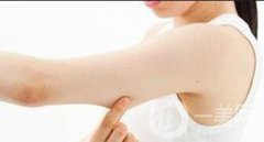 手臂舉升手術(shù)康復：時間線+提示