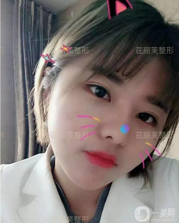 面部光纖溶脂