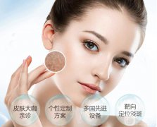 *風(fēng)范祛斑果怎么樣?大概多少錢？