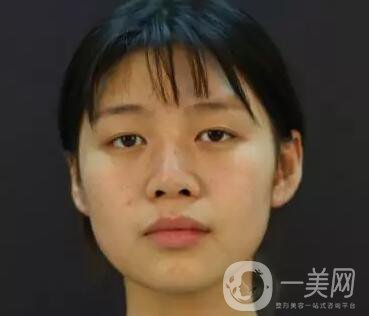 石家莊整形美容信息介紹？美聯(lián)臣整形怎樣？美聯(lián)臣價(jià)格