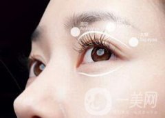 割雙眼皮有哪些風(fēng)險(xiǎn)？有失敗的嗎？