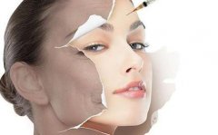 打玻尿酸的危害？不打了會(huì)反彈嗎？