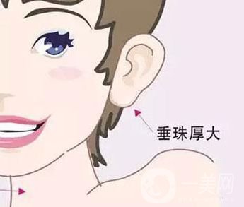 玻尿酸豐耳垂大約多少錢(qián)