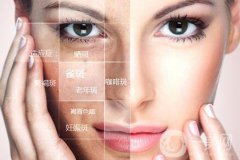 像素激光好嗎?有沒有危害嗎?術后如何護理?