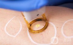 光電美容項(xiàng)目有哪些呢？光電美容簡(jiǎn)單介紹