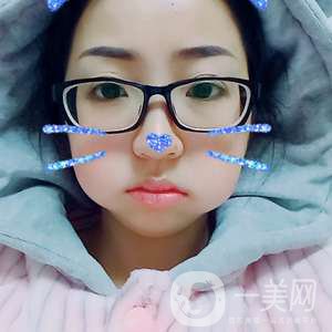 去頰脂墊瘦臉
