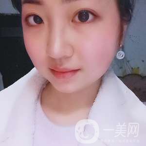 去頰脂墊瘦臉、