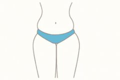 360度環(huán)形吸脂果如何 有哪些優(yōu)勢(shì)呢