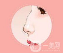 駝峰鼻矯正方法有哪些呢 多久才能恢復(fù)正常