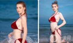 乳房縮小是為了什么呢 來(lái)聽(tīng)聽(tīng)專(zhuān)家的解說(shuō)