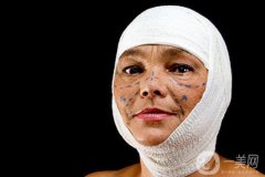 為什么韓國(guó)整形率是*TOP1？