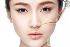 西方隆鼻與*隆鼻的區(qū)別！