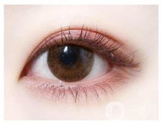 切開(kāi)雙眼皮適合人群有哪些呢？