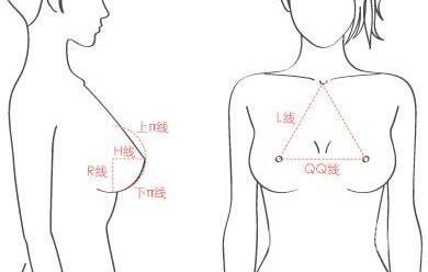 假體隆胸術(shù)有哪些特點？