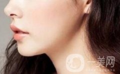 硅膠墊下巴硬得像石頭，多久能恢復(fù)？