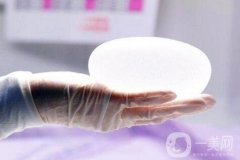 假體隆胸有哪些優(yōu)勢和缺點?為小白詳細(xì)解說