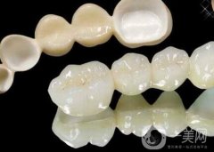 二氧化鋯全瓷牙修復(fù)果怎么樣？