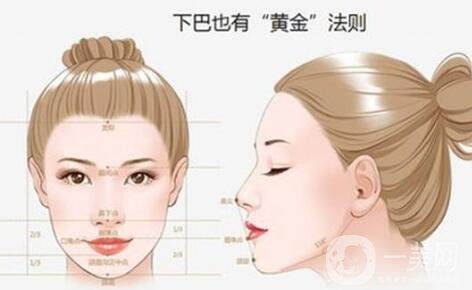 玻尿酸墊下巴