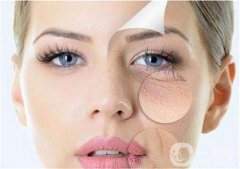 激光去眼袋的價格多少？要打幾次？