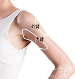 上臂吸脂多久恢復(fù)？需要住院嗎？