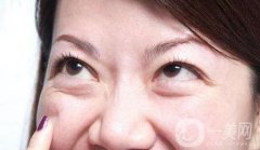 去眼袋手術(shù)價格是多少？與哪些因素有關(guān)？