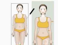 全身吸脂減肥好多錢？手術(shù)價格多少？