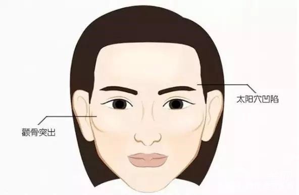 顴骨內(nèi)推和磨骨之間的區(qū)別是什么？哪個*果好些？