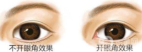 開眼角價位