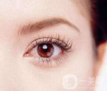 開眼角價位