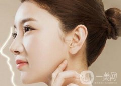 隆鼻后怎么消腫比較快呢？幾個(gè)妙招分享