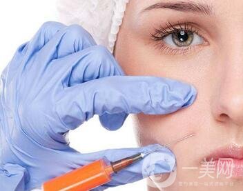 臉部除皺手術有哪些？這些方法值得推薦！