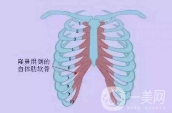 肋軟骨隆鼻為什么老受推薦？到底好在哪里？