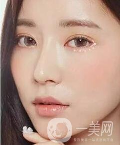 開眼角前后照片圖，放大眼睛不是一點(diǎn)點(diǎn)